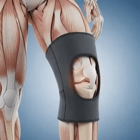 IronKnee™ Knee Guard